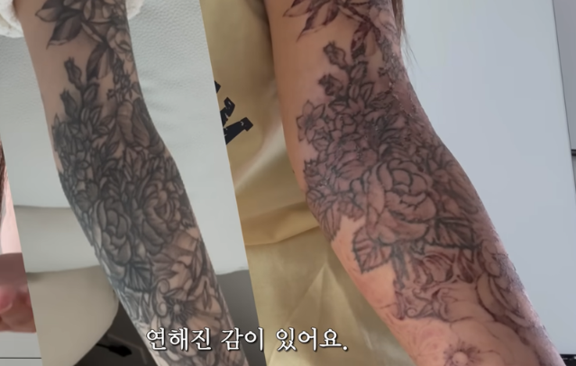 "죽을 것 같다"는 그 경험… 유튜버의 '팔 전체 문신' 지운 후기