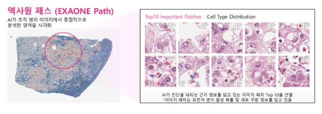 "2주 걸리는 암 검사, 1분이면 충분" 의료AI 개척하는 'LG의 진심'