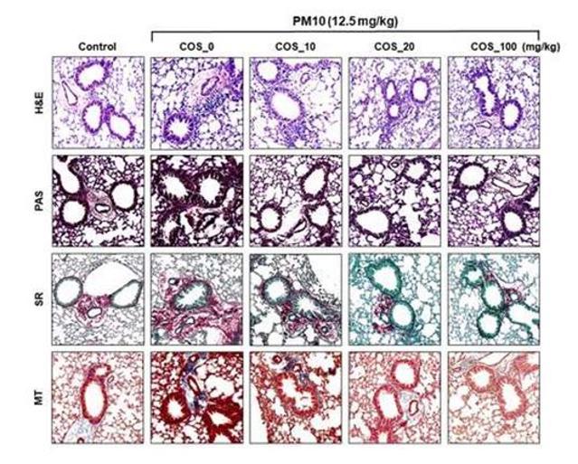 아미코젠, ‘키토올리고당’으로 미세먼지 폐 질환 잡는다