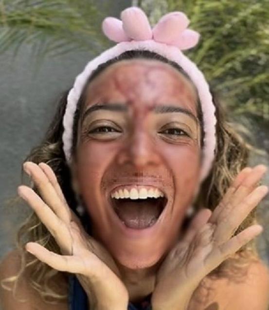 SNS서 유행하는 충격적 동안 비결..'그 피'를 얼굴에 바른다고? [헬스톡]