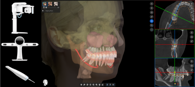 "5D 업그레이드" 레이, 구강스캔 자동정합 신기술 공개