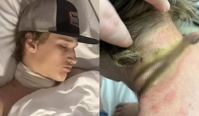 "온몸이 새까매졌다"..잠자며 휴대폰 충전하다 목숨 잃을 뻔한 8세 소년, 무슨 일