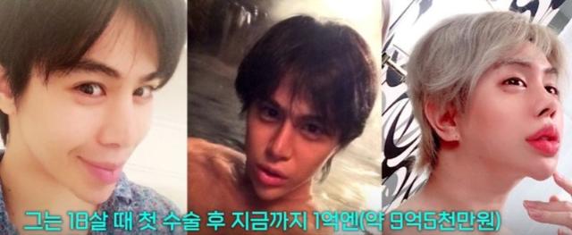 "10억 들여 성형했다"..왕따에서 셀럽으로 변신한 학폭 피해男 [헬스톡]