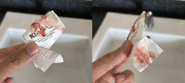 “지하철서 피 묻히고 달아나” 방콕 지하철 ‘혈액 테러’에 감염병 확산 우려